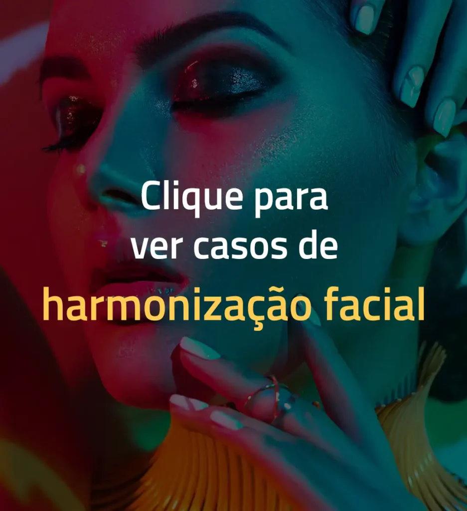 veja casos de antes e depois da harmonização facial aqui no cir hospital odontológico de brasília lago sul lago norte noroeste par way octogonal