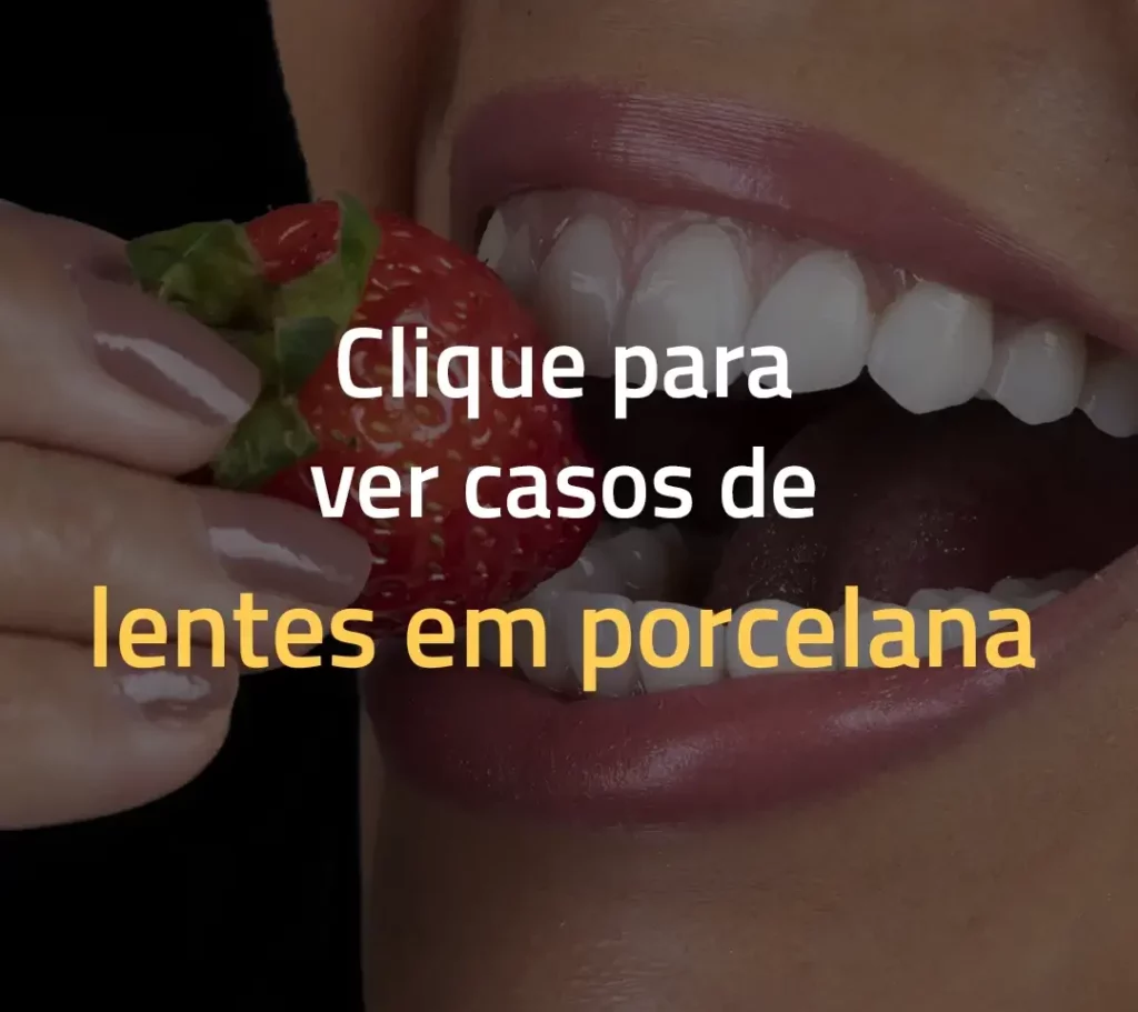 tratamento de reabilitação oral com as lentes facetas dentais em porcelana no cir lago sul lago norte asa sul asa norte parkway