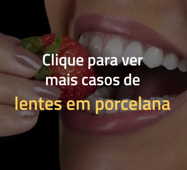 veja casos de antes e depois de facetas dentais no cir lago sul lago norte asa sul asa norte